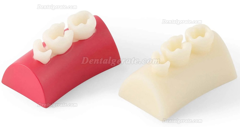 Dental Inlay &Uuml;bungsblock Komposit-Harz F&uuml;llung Z&auml;hne